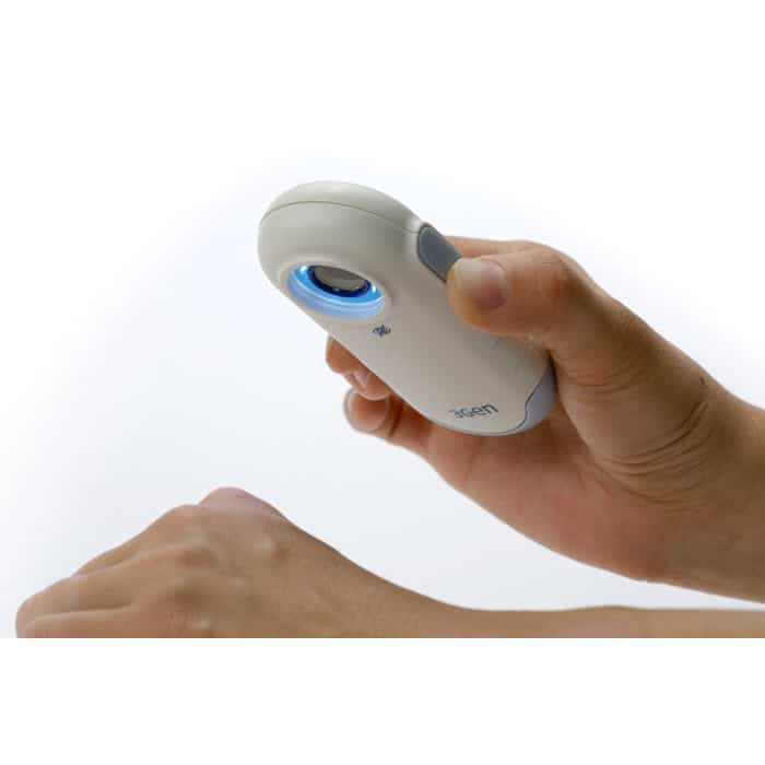 Dermlite dl100